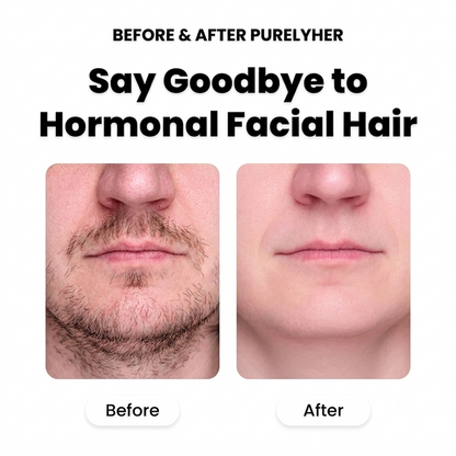 PurelyHer Facial Epilator